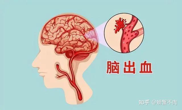 高血压的危害你注意了吗？